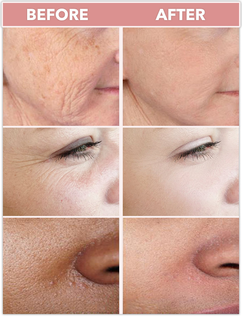 Off-Fix the cream of wrinkles