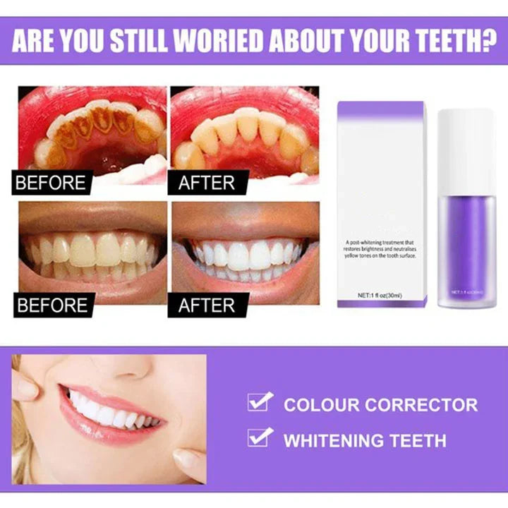 🦷Flash Sale - Teeth Colour Corrector Serum